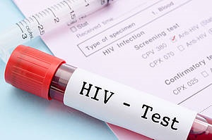 Gesundheitsamt Pfaffenhofen - Anonyme und kostenlose HIV-Testung start